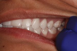 Virtual Consultation Right Teeth