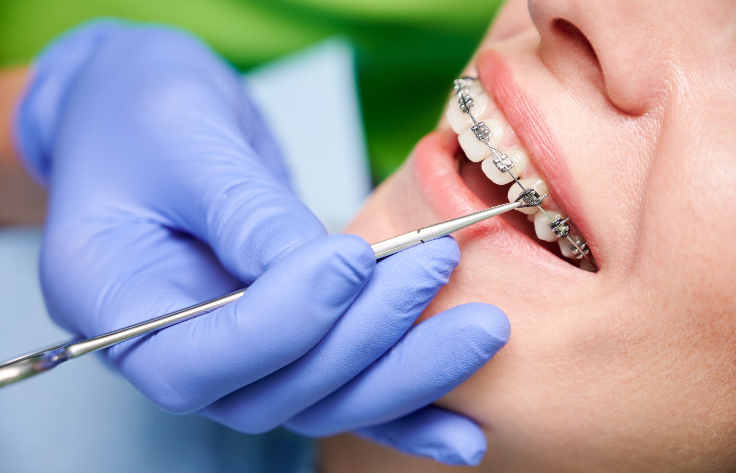 Orthodontic services provided in Sandy, UT